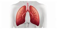 
Lung Transplant
